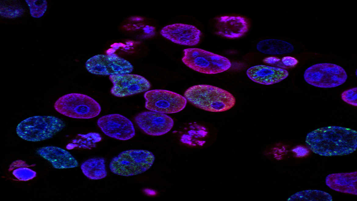 What Is Single Cell Spatial Transcriptomics